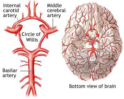 Carotid - Brain